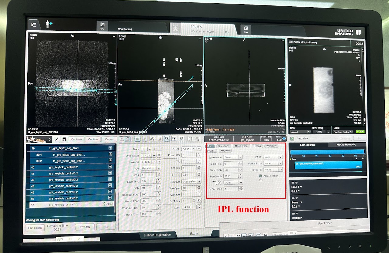 IPL function software